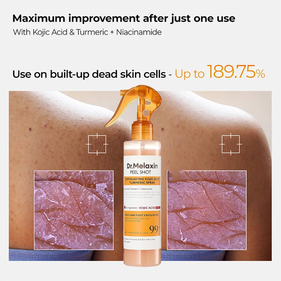 Kojic Acid Turmeric Exfoliating Spray 200ml | Body Keratin Care | Gentle Exfoliation | Leaves Skin Radiant