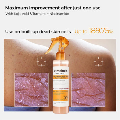 Kojic Acid Turmeric Exfoliating Spray 200ml | Body Keratin Care | Gentle Exfoliation | Leaves Skin Radiant