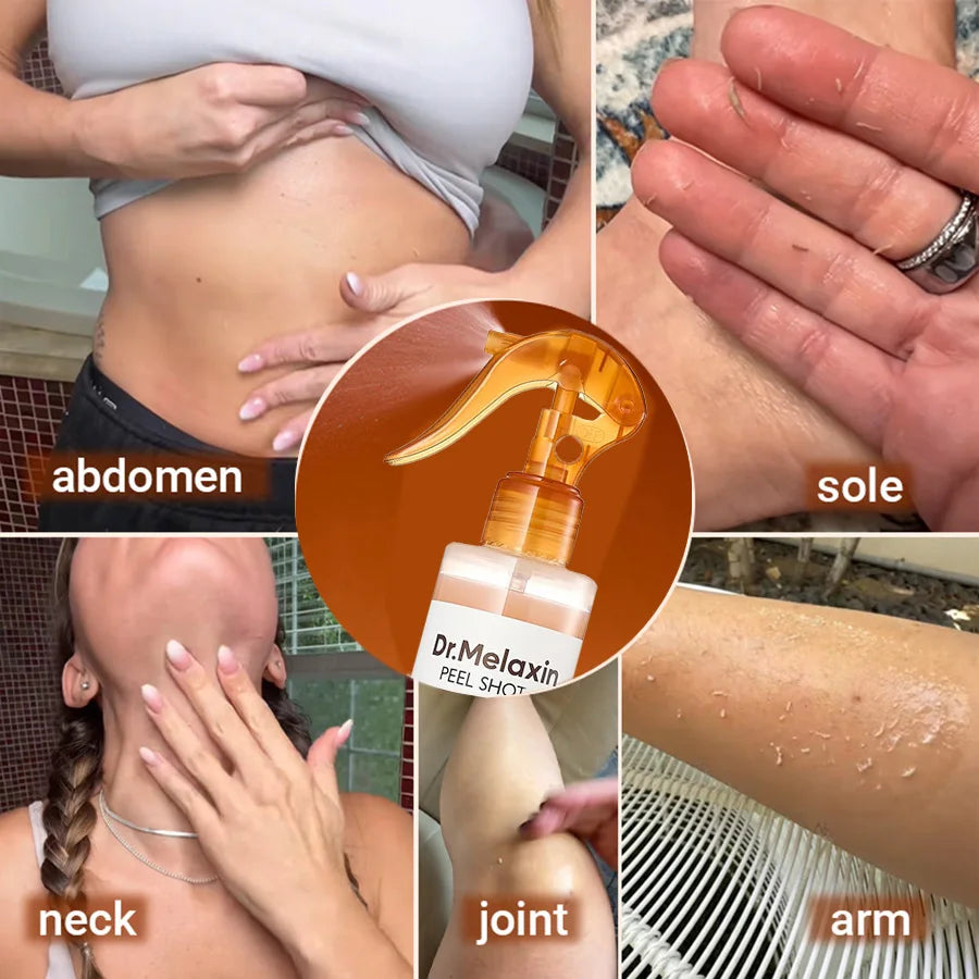 Kojic Acid Turmeric Exfoliating Spray 200ml | Body Keratin Care | Gentle Exfoliation | Leaves Skin Radiant