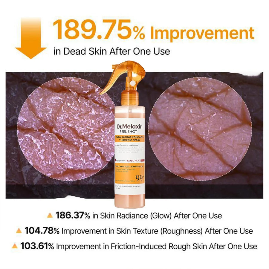 Kojic Acid Turmeric Exfoliating Spray 200ml | Body Keratin Care | Gentle Exfoliation | Leaves Skin Radiant